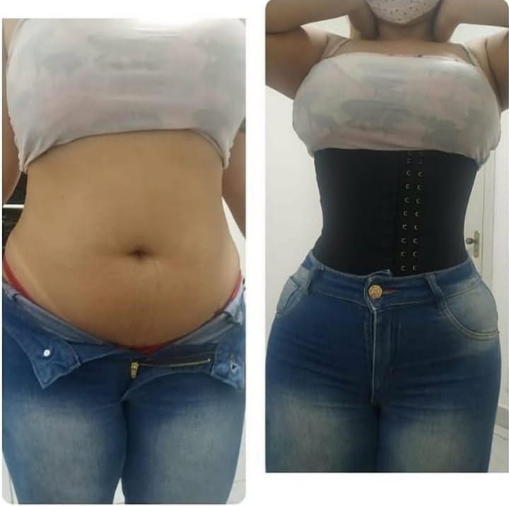 Antes e depois - Ana Paula S.