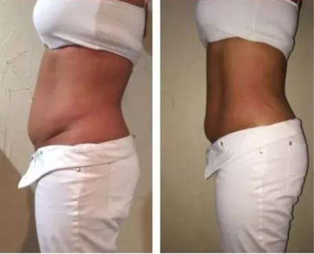 Antes e depois - Camila R.