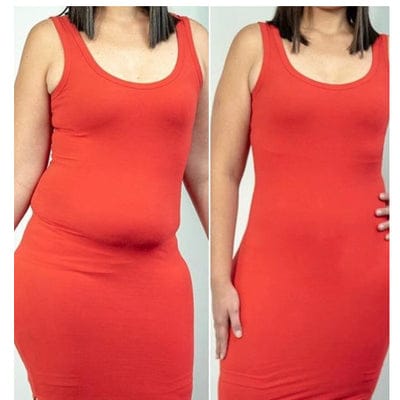 Antes e depois - Beatriz O.